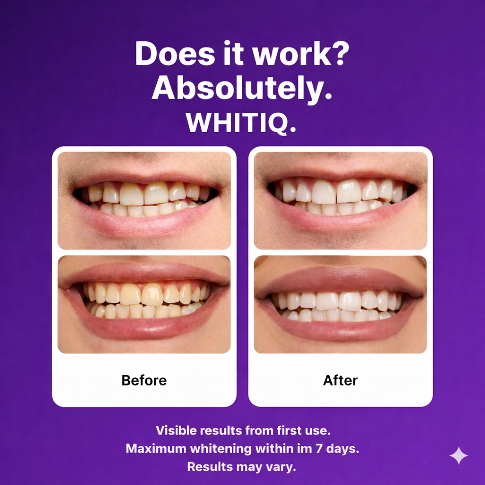 DRDENT Purple Teeth Whitening Strip